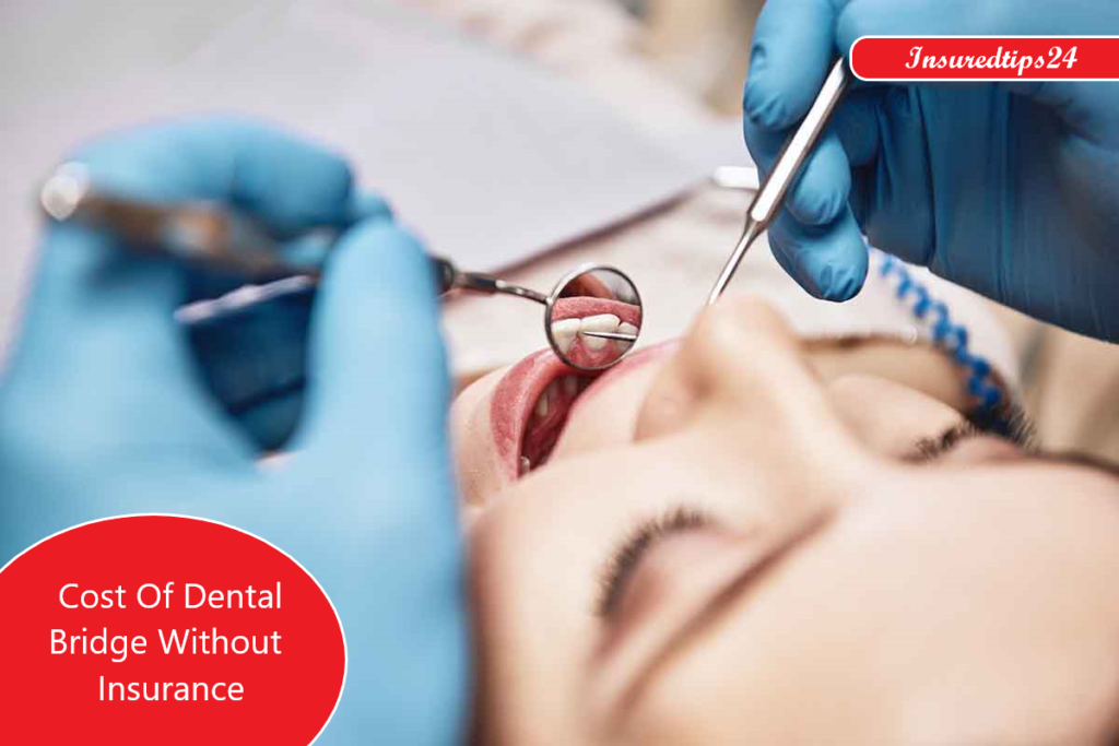 How much dental bridge cost without Insurance